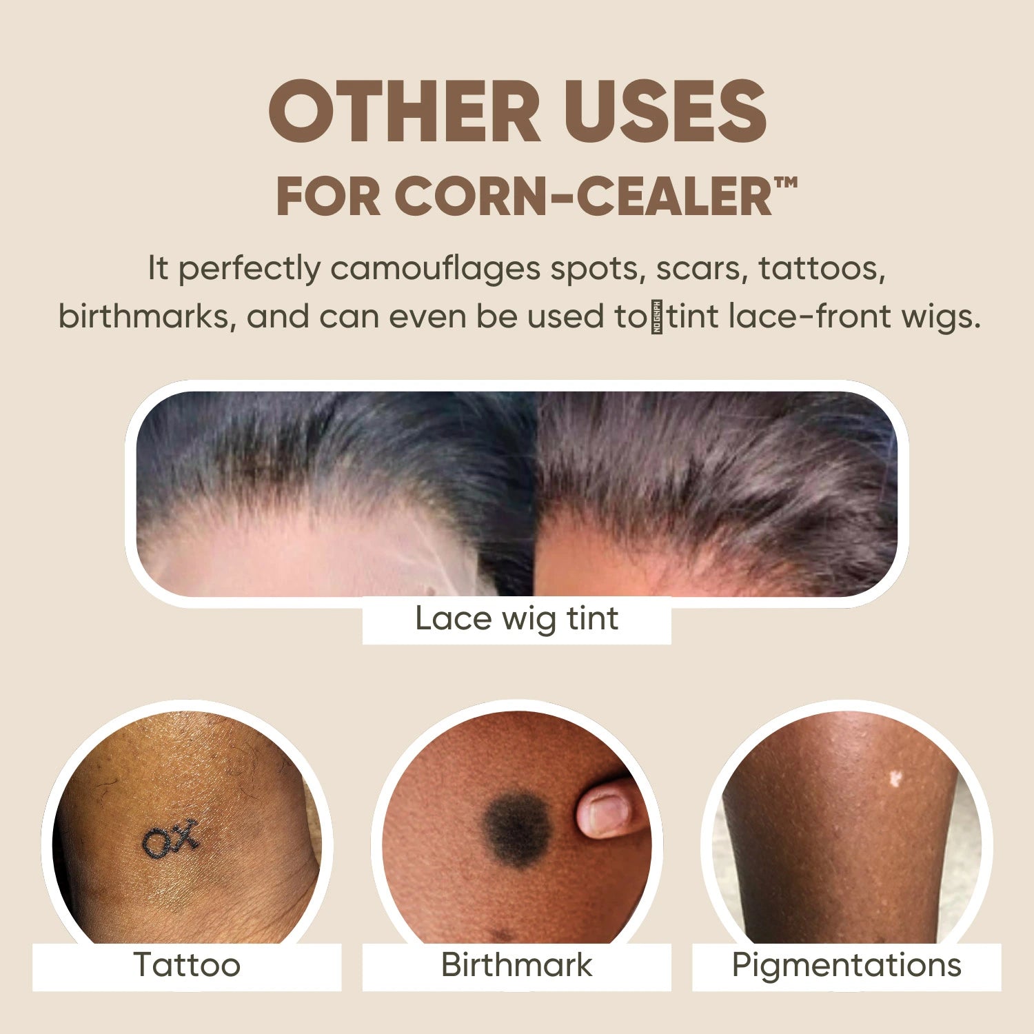 Toe Corn Concealer