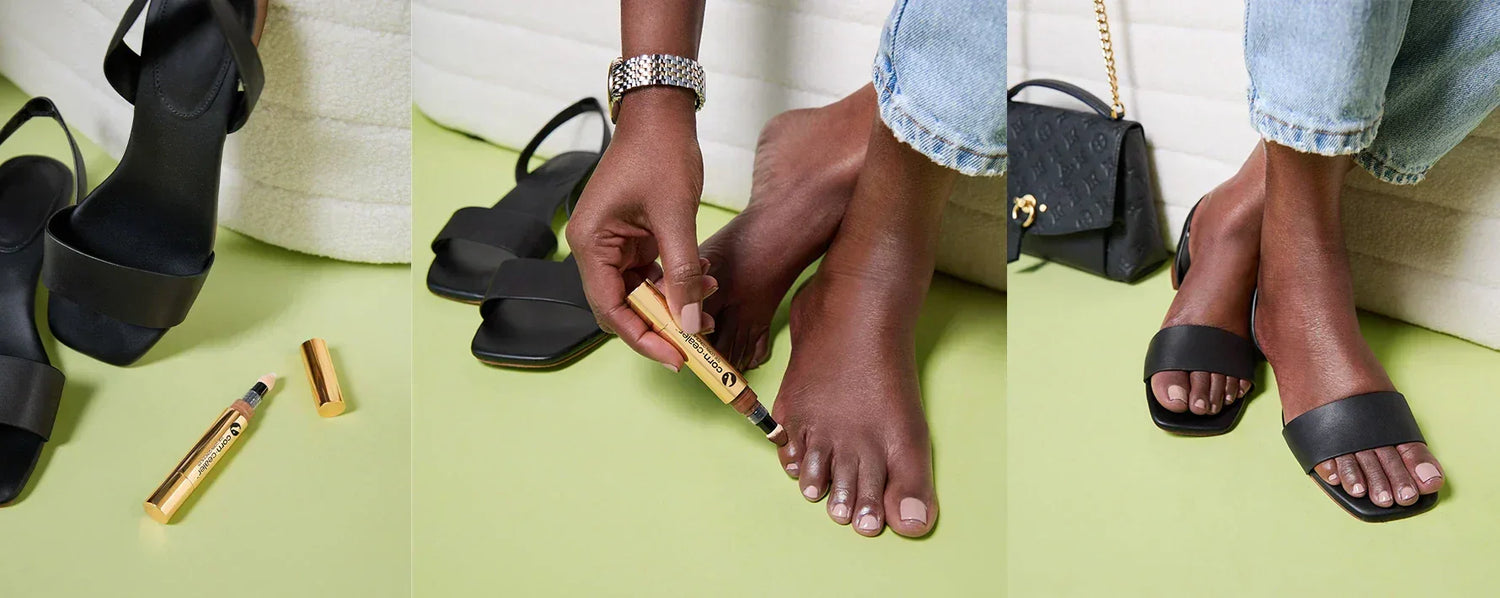 How to Use Corn‑Cealer for Perfect Sandal-Ready Feet