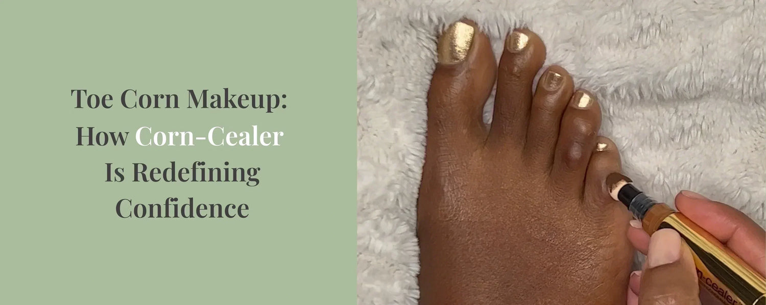 Close up of black woman's foot with toe corns, with caption: The 
