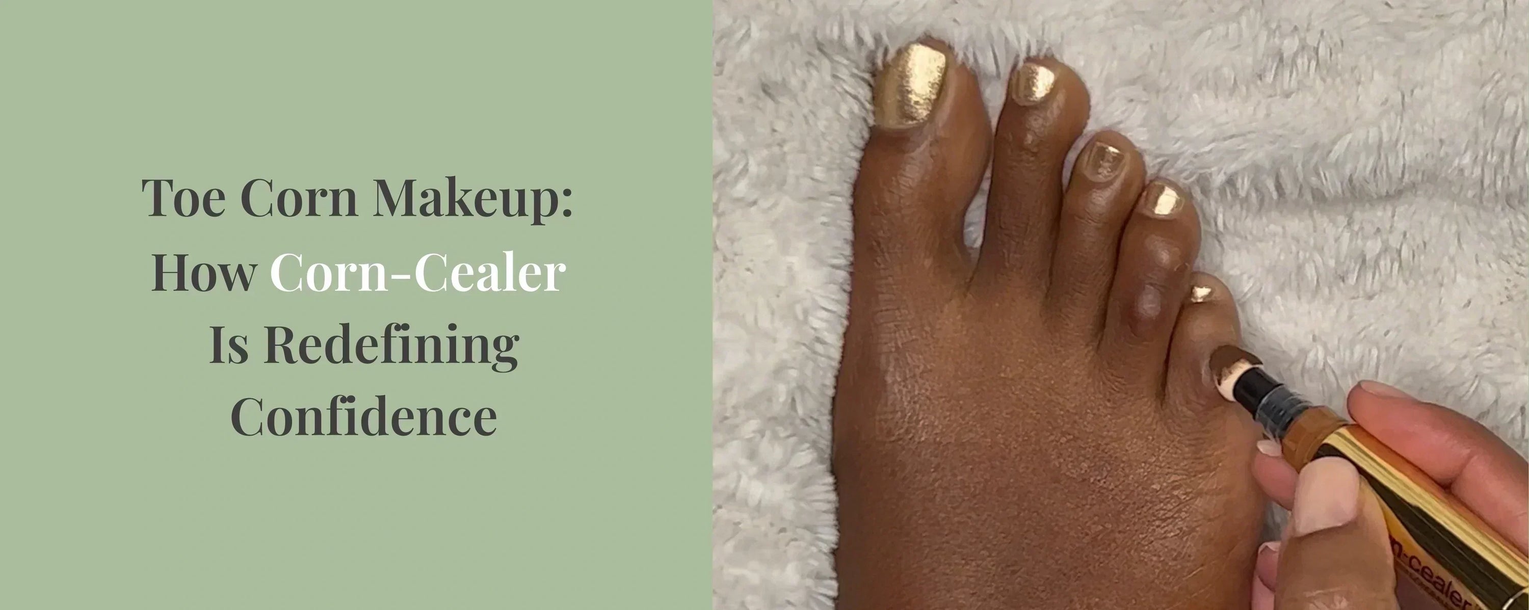 Close up of black woman's foot with toe corns, with caption: The 
