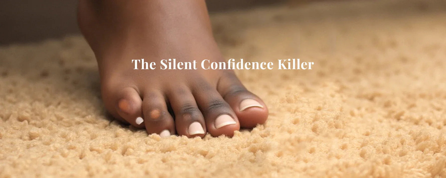 Black woman's foot with toe corns