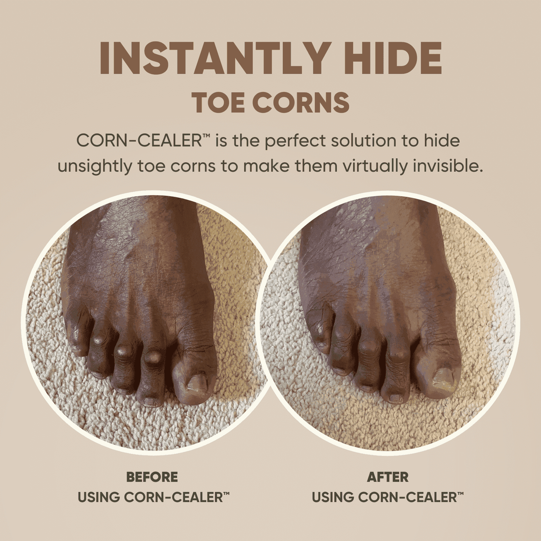 Toe Corn Concealer provides flawless coverage for toe corns. Before and after comparison shows instant, natural-looking results.