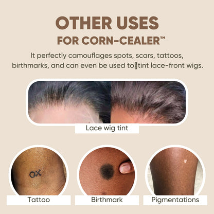 Toe Corn Concealer