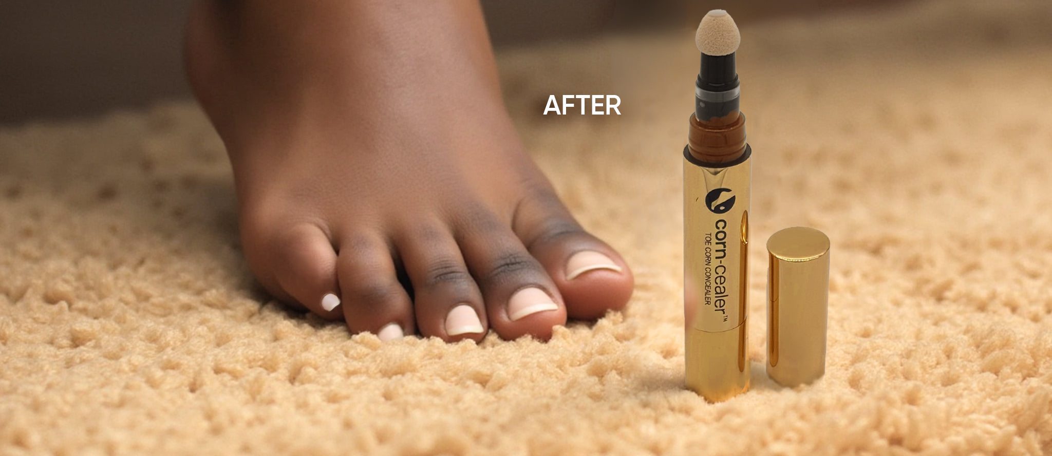 Black woman's toes with corns covered using Corn-Cealer, with a Corn-Cealer pen placed beside her foot.