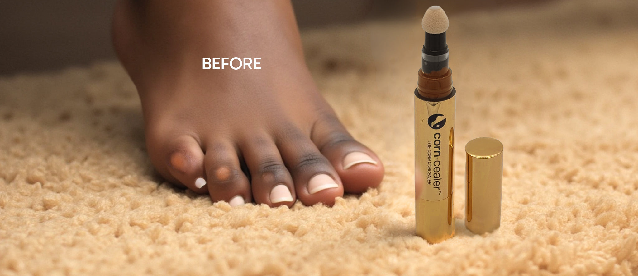 Close-up of a Black woman's toes with visible corns before Corn-Cealer Toe Corn Makeup is applied, with a Corn-Cealer pen placed beside her foot.